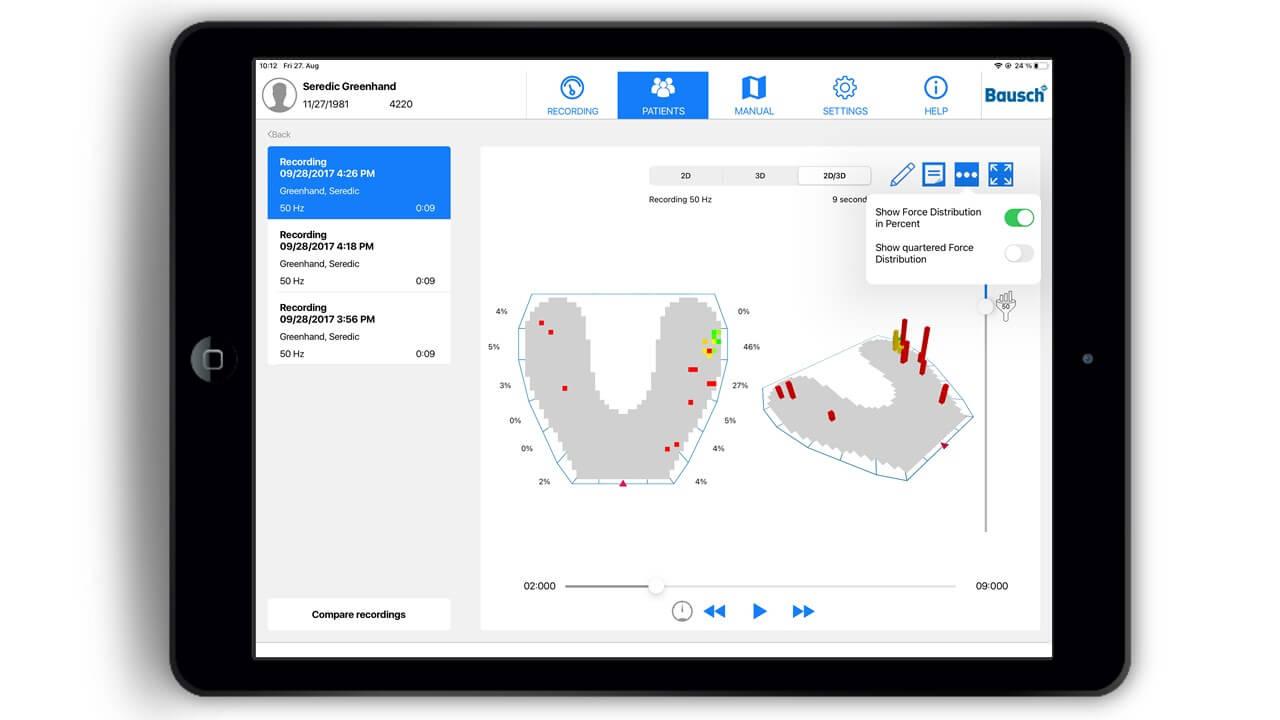 BAYOOMED - Digitale Revolution für die Zahnmedizin: Von der Idee zu OccluSense®