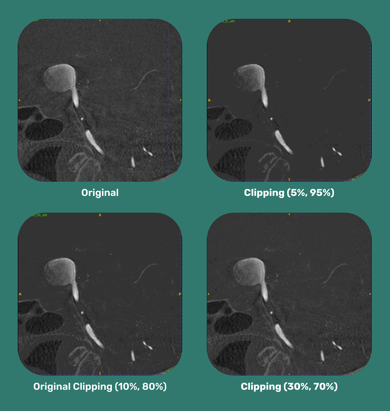 IndiPlant BAYOOMED Success Story-Preprocessing Denoising IndiPlant BAYOOMED Success Story-Preprocessing Denoising