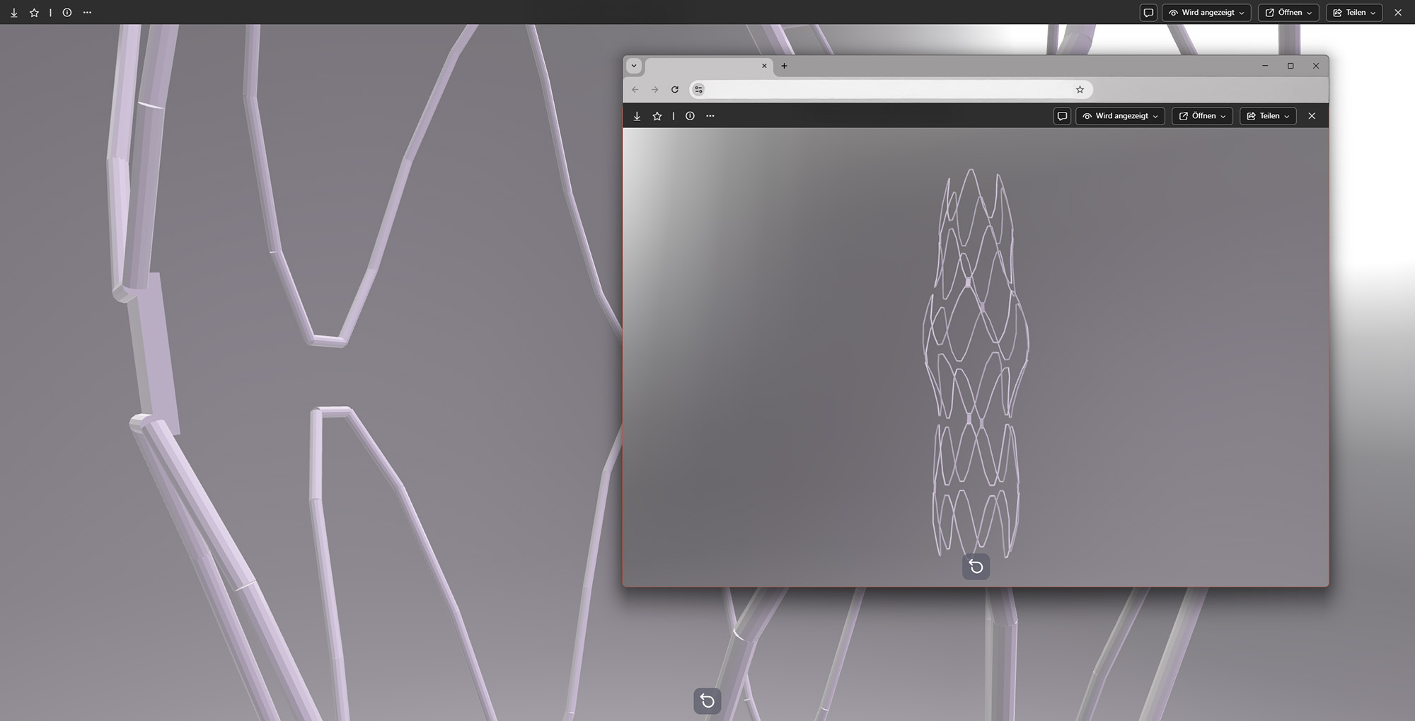 Indiplant-Screenshot Stent Indiplant-Screenshot Stent